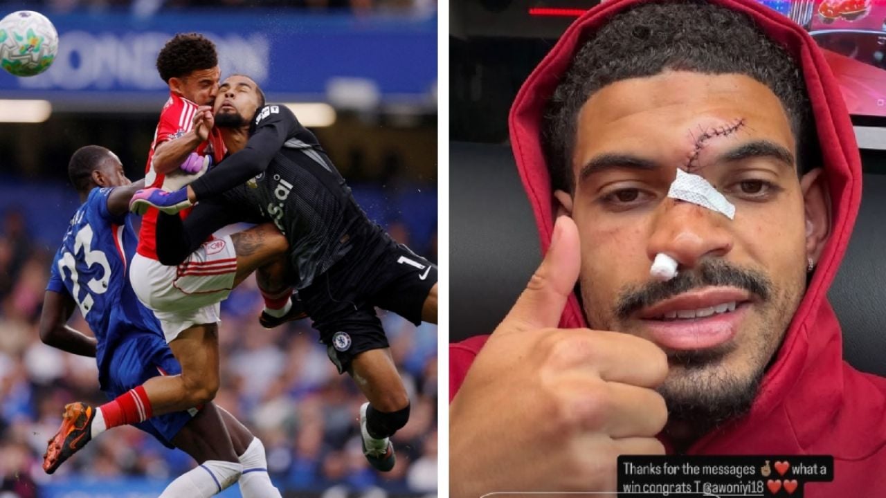Jugador del Nottingham Forest sufre lesiones faciales tras choque con el portero del Chelsea