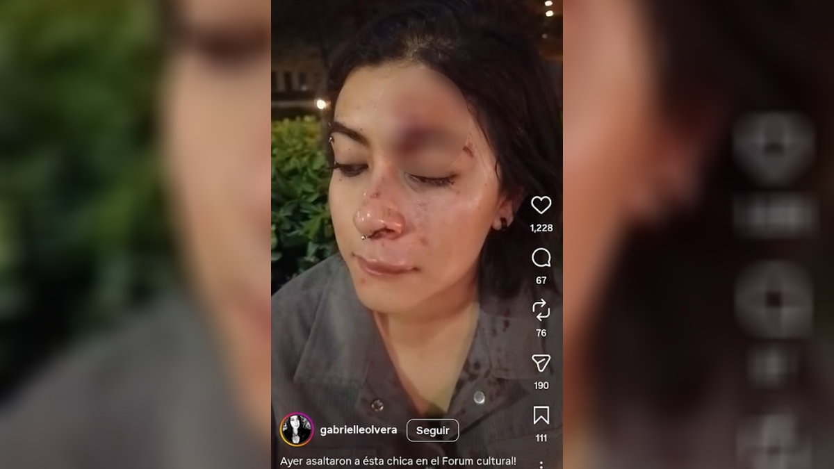 León: Golpean a joven en Forum Cultural, genera preocupación ciudadana