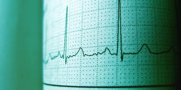 Guerrero: Sismo de 5.6 grados registrado hoy, con réplicas en CDMX