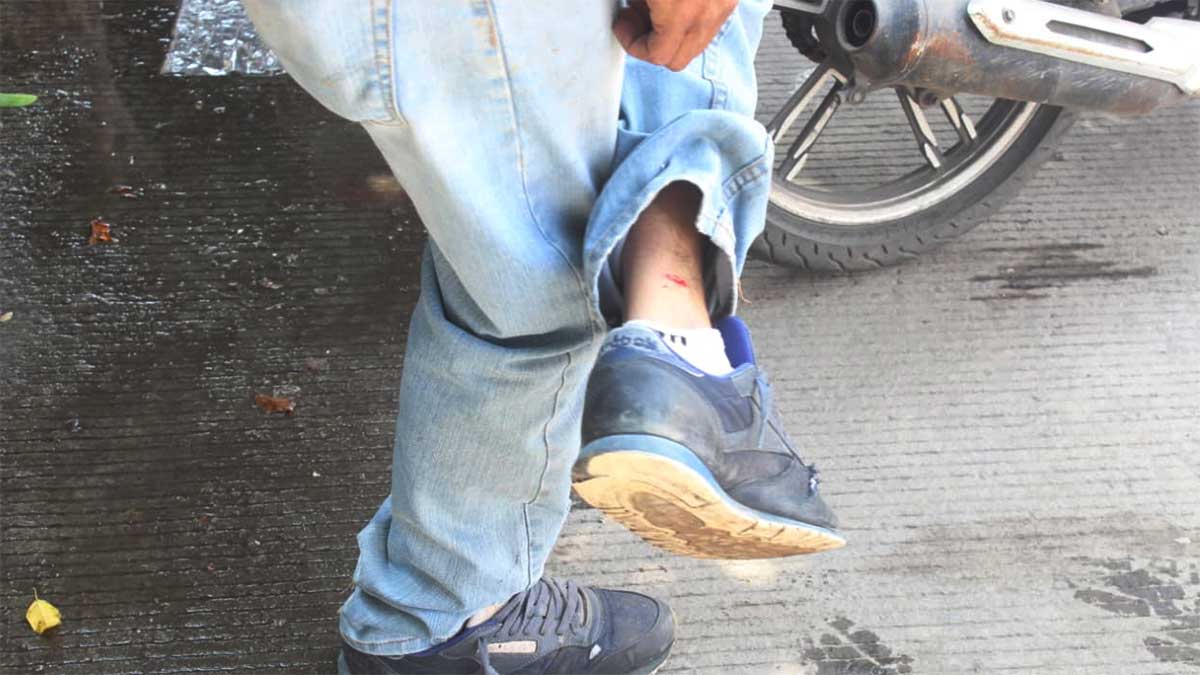 León: Percance vial en colonia Obregón, motociclista herido por disparos