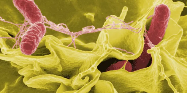 Florida: Alerta por bacteria come carne que podría llegar a México