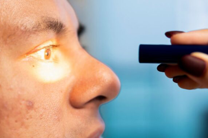 Radiación UV: Aumenta riesgo de daños oculares, informan oftalmólogos