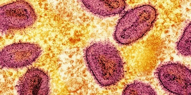 México: Hospital General omite aviso a la UNAM por brote de salmonelosis