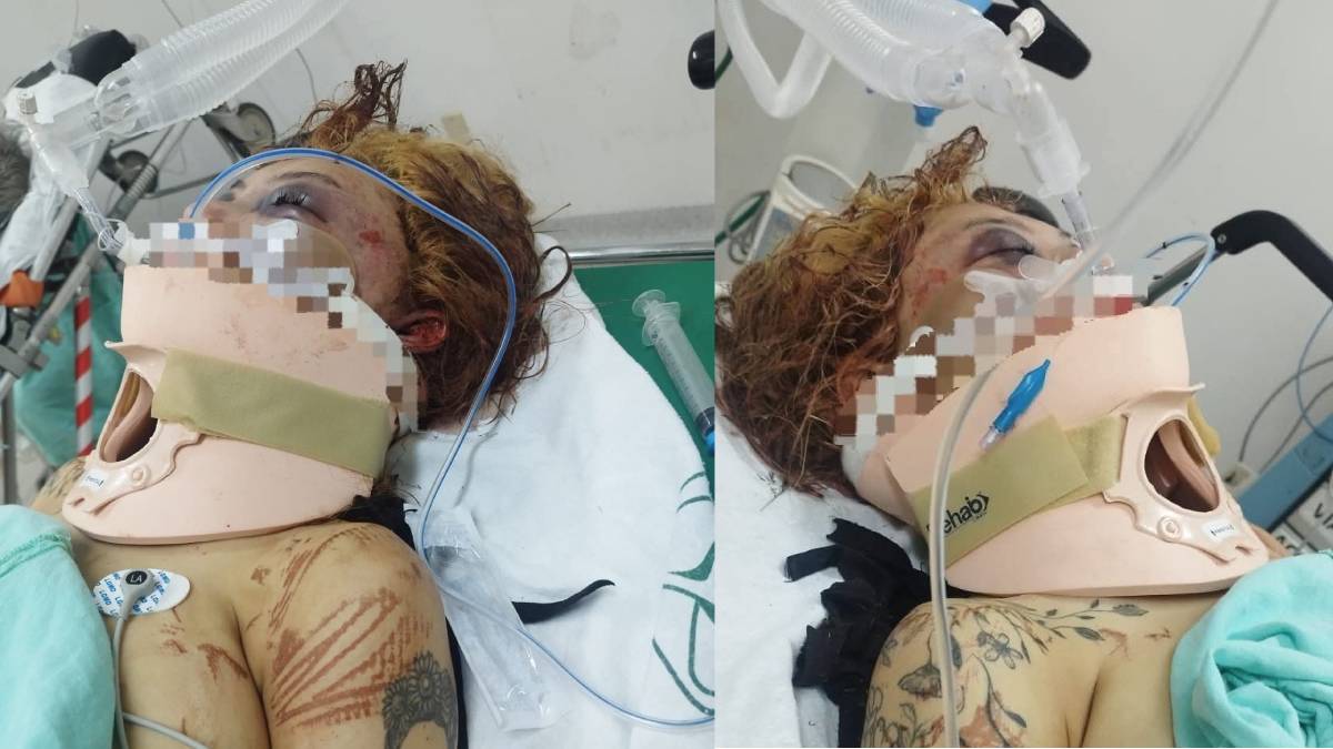 Mujer golpeada en la carretera León-Aguascalientes: atención inmediata requerida